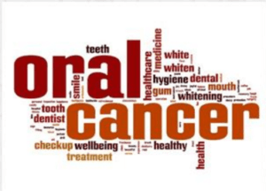 oral cancer screening sarasota