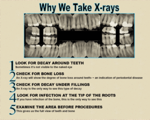 digital dental xrays sarasota